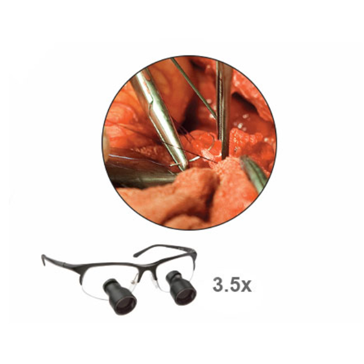 Standard Field Surgi-Spec® Telescopes - Image 4