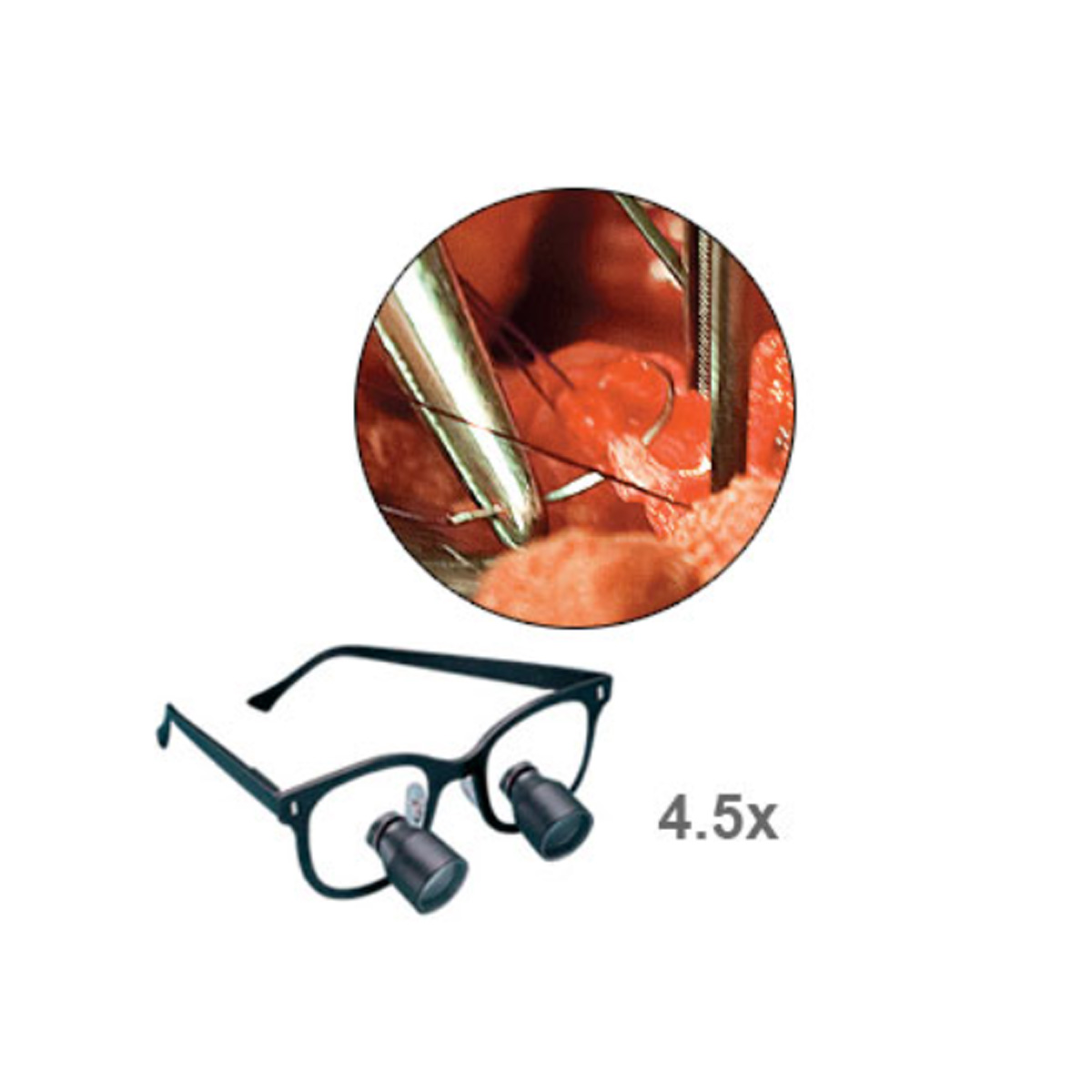Standard Field Surgi-Spec® Telescopes - Image 5