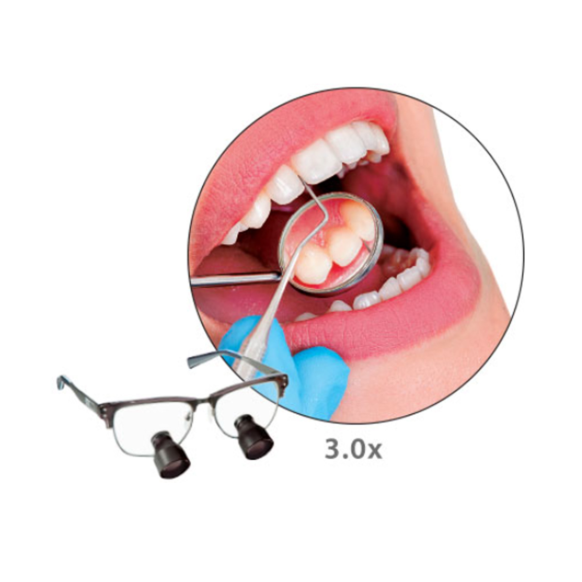 Standard Field Dental Telescopes - Image 2