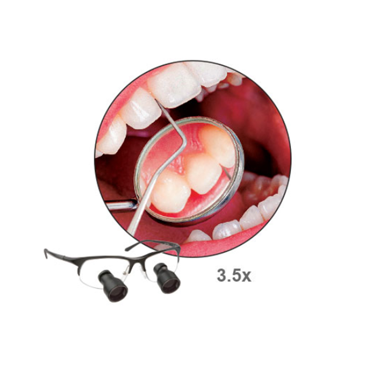 Standard Field Dental Telescopes - Image 3